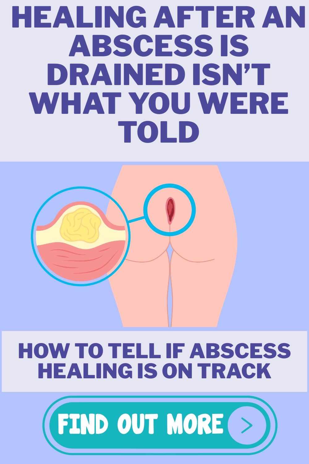 Healing After an Abscess Is Drained: What Most Patients Aren’t&nbsp;Told